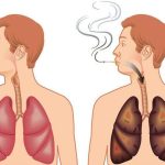 Баянзүрх, Хан-Уул дүүрэгт сүрьеэгийн идэвхтэй илрүүлэлт ӨНӨӨДРӨӨС эхэлж байна